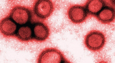 Menina de 12 anos morre por gripe H3N2 em SC, diz Dive